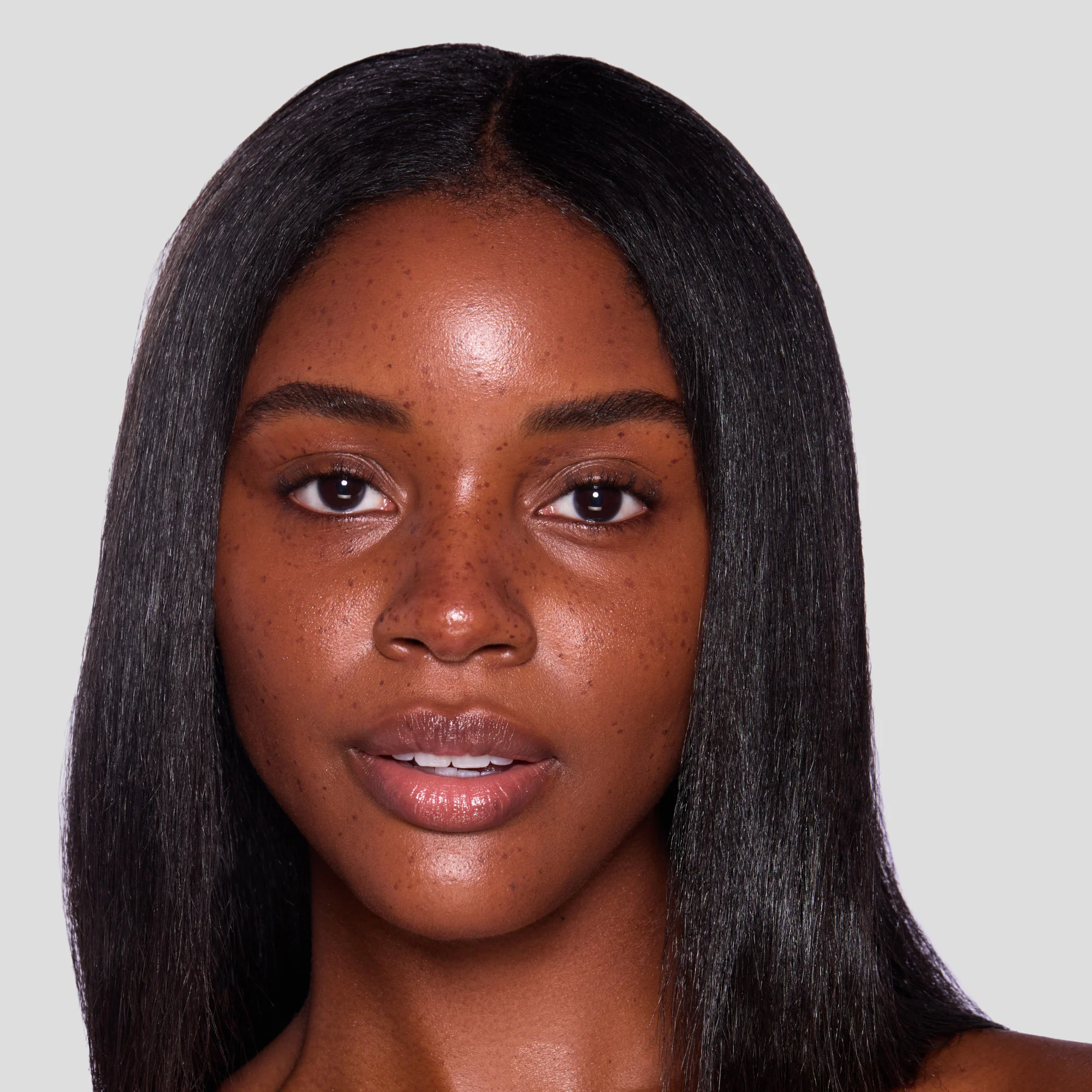 FRECKLES - Image 10