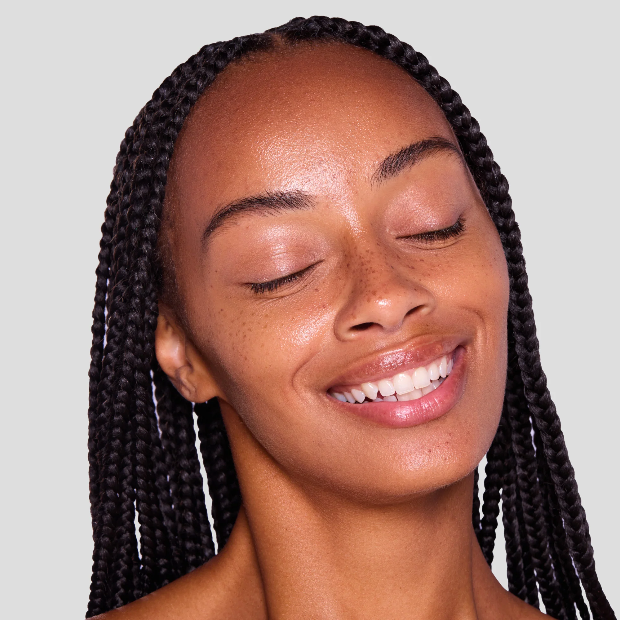 FRECKLES - Image 6